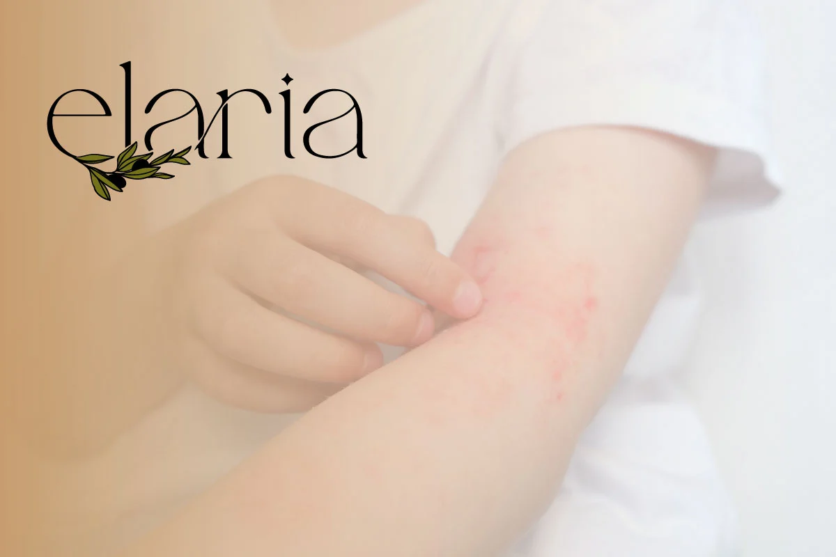 Personalized Eczema Evaluation by Elaria